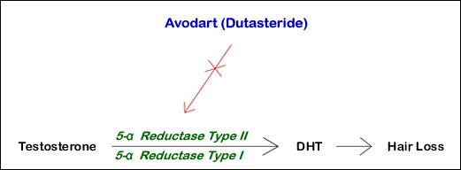 Avodart Inhibits DHT Production, Reducing Hair Loss