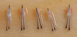 Robotically Harvested 2-Hair Follicular Unit Grafts